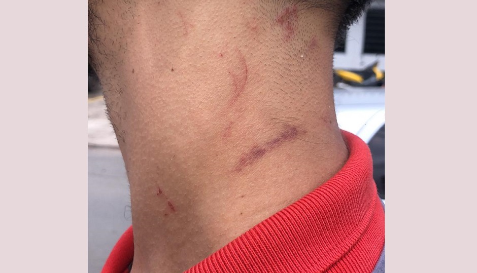 Danilo Marques Pereira, de 24 anos, cliente de boate que denuncia agressão de segurança de estabelecimento (Foto: Reprodução / Arquivo Pessoal)