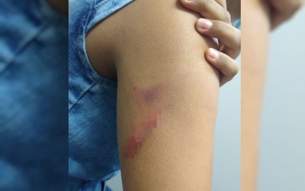 Menina foi ferida no braço pelo pai, que foi solto um dia após ser detido (Foto: Reprodução/TV Anhanguera)