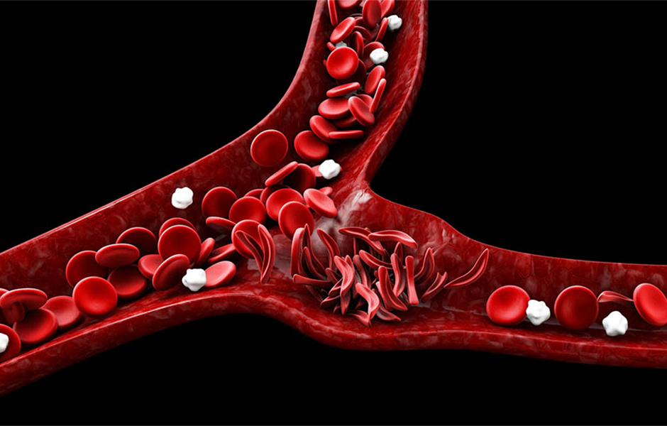 Suspeita de coronavírus é descartada em Goiás