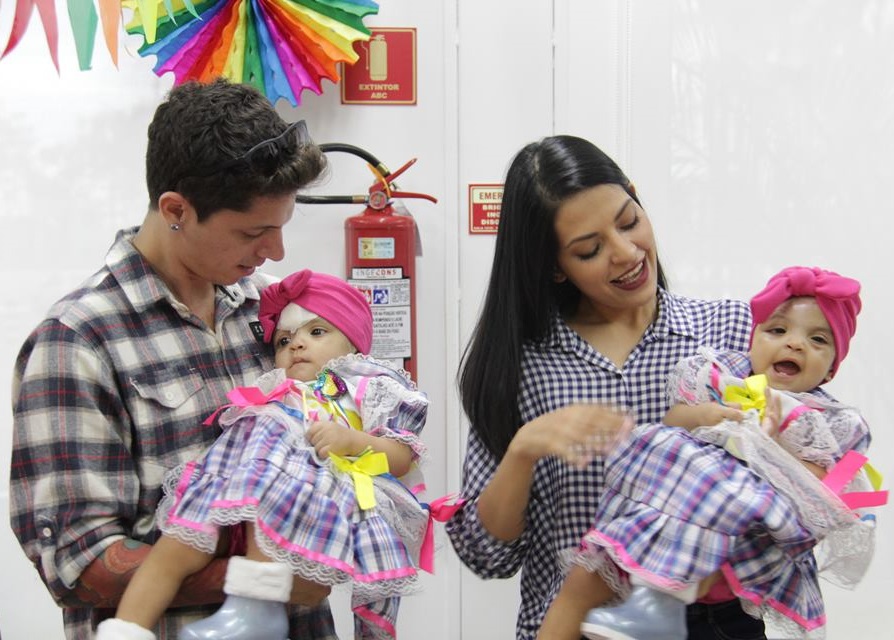 As gêmeas siamesas comemoraram o aniversário de um ano no hospital (Foto: Divulgação/Hospital da Criança de Brasília)