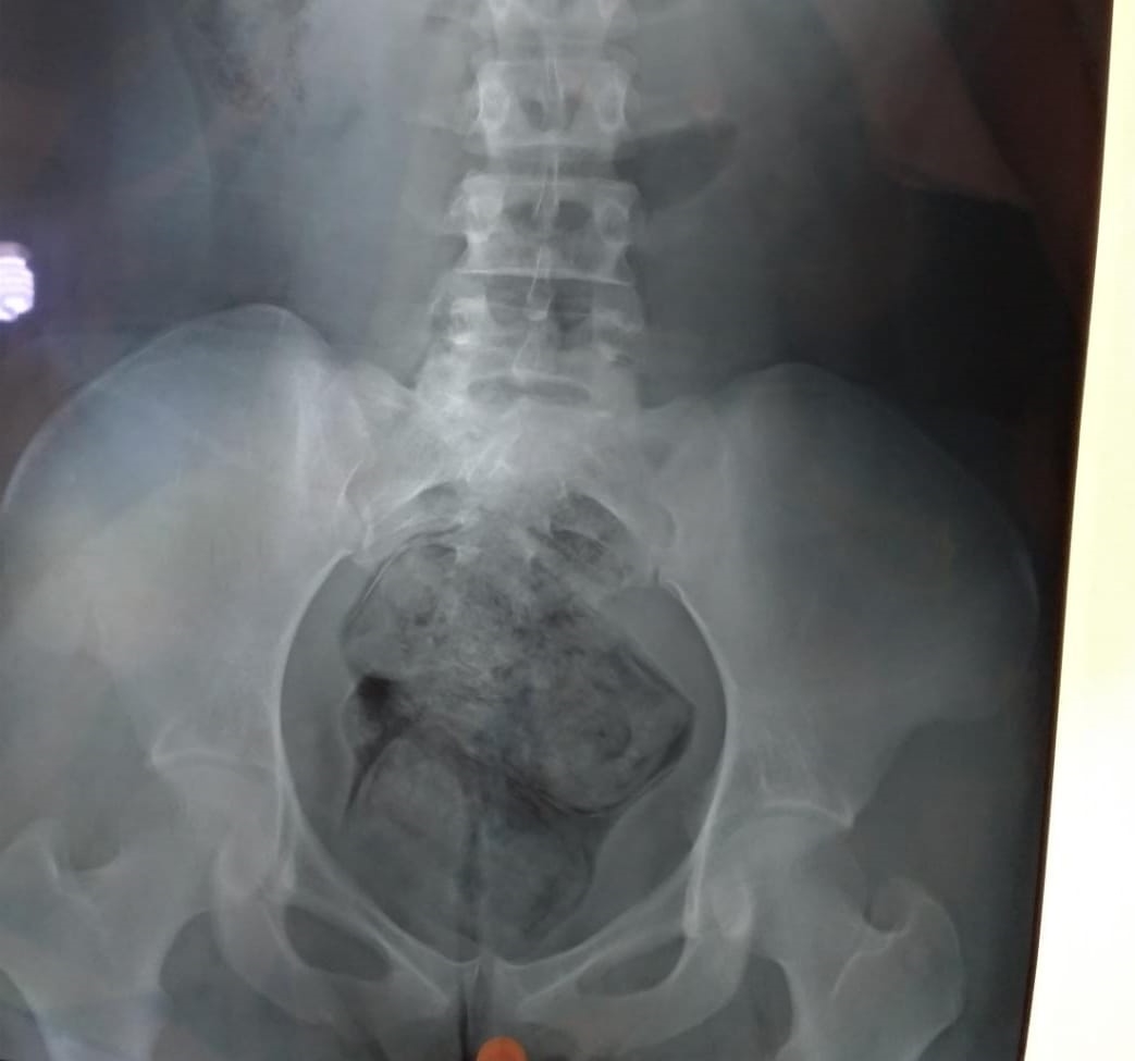 (Foto: Divulgação/DGAP)