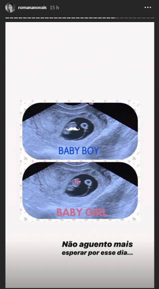 Ultrassom do filho de Alok e Romana Novais