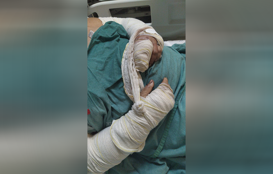 Mulher denuncia espancamento após discussão com vereador em Itaguari(Foto: Arquivo Pessoal)