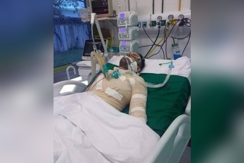 Morre rapaz que teve 40% do corpo queimado pela ex-namorada, no Rio de Janeiro