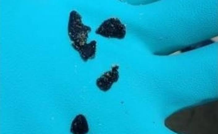 Fragmentos de óleo chegam pela primeira vez ao litoral do Rio de Janeiro