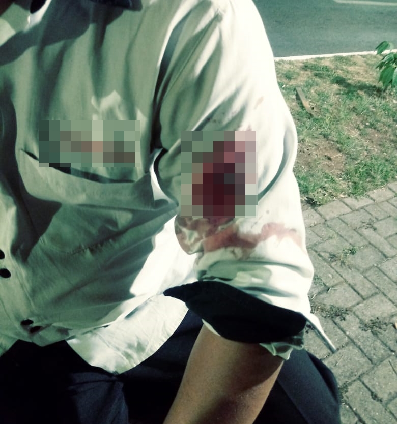 Homem é preso ao ferir vítima com chave de fenda durante assalto, em Goiânia