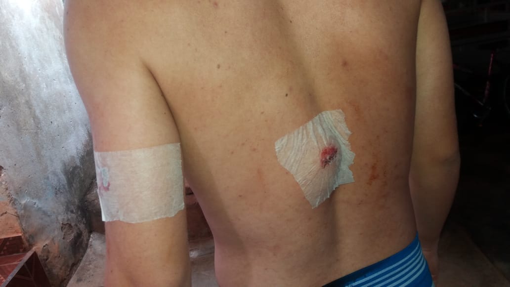 Cortes foram superficiais e não atingiram órgãos. Sangramento pode ser visto através de uniforme, no vídeo (Foto: reprodução/internet)