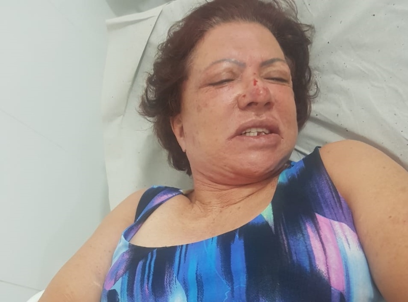 Ex-primeira-dama de Itaberaí é novamente agredida após assalto em casa