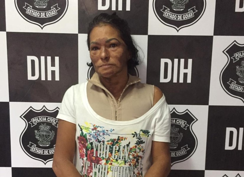 Ela, que também foi atingida pelo fogo, chegou a afirmar a vítima era a responsável por tentativa de homicídio contra ela (Foto: divulgação/PC)