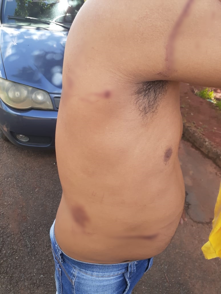 Motorista denuncia ter sido torturado por patrão após ser acusado de furto de R$ 8 mil (Foto: Divulgação)