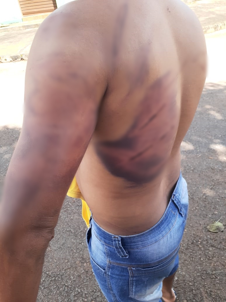 Motorista denuncia ter sido torturado por patrão após ser acusado de furto de R$ 8 mil