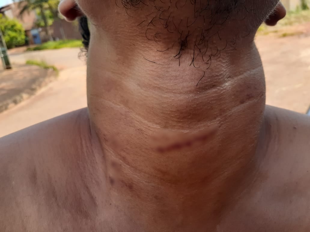 Motorista denuncia ter sido torturado por patrão após ser acusado de furto de R$ 8 mil