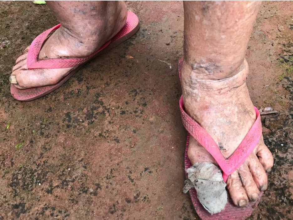 Dois casos de maus tratos contra idosos foram encontrados no mesmo dia, em Anápolis