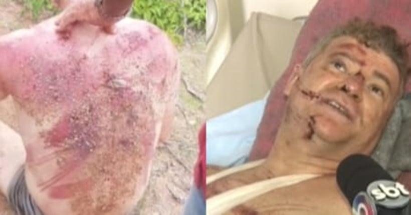 Professor sofre chicoteamentos e é espancado por homofobía na Paraíba