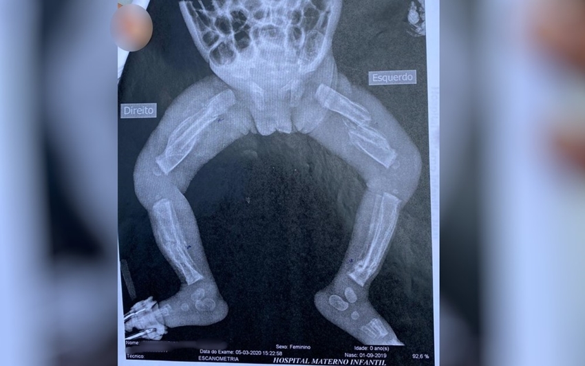 Avó de criança espancada até a morte diz que se soubesse das agressões, teria salvo a neta