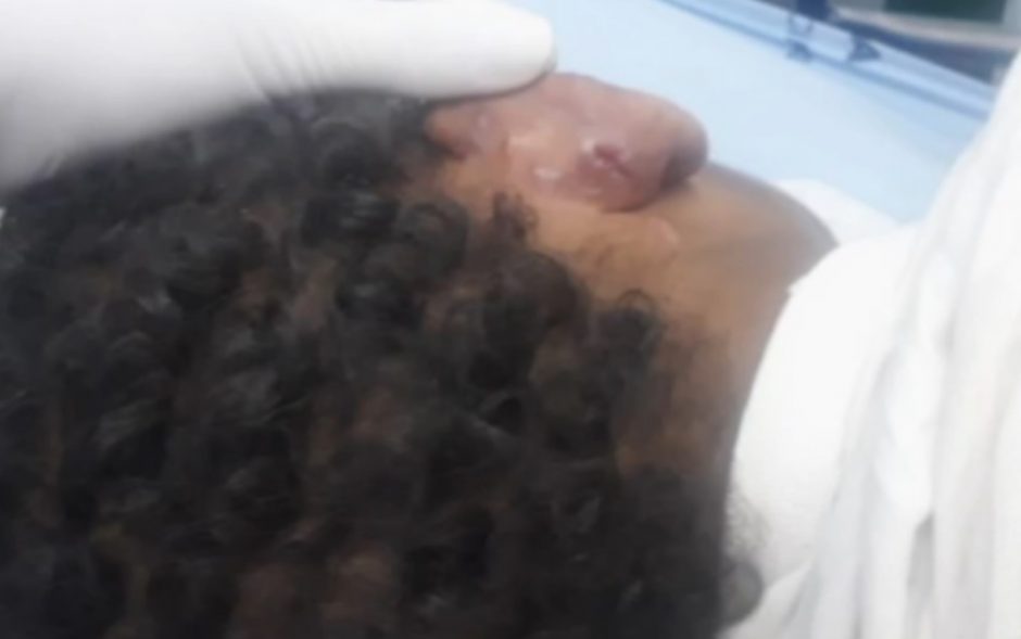 Idosa é presa suspeita de agredir neto de sete anos, em Aparecida de Goiânia