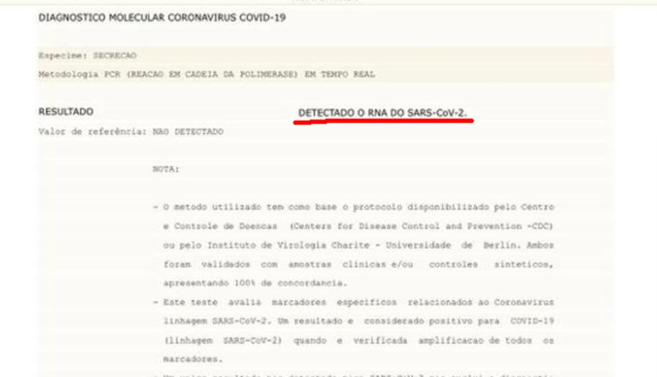 Teste positivo para coronavírus Sars-Cov-2 que causa a Covid-19 (Foto: Arquivo Pessoal/ Divulgação)