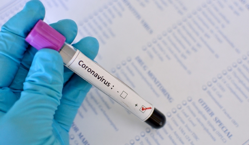 Goiás tem 56.078 casos confirmados de Covid-19 e 1.392 óbitos, no total