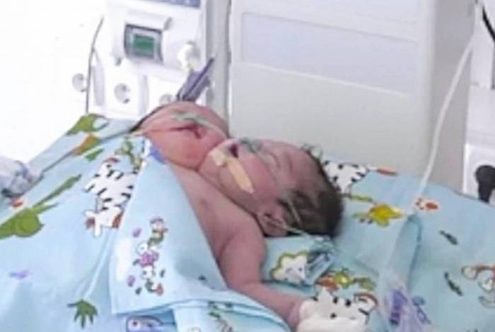 Sogro força mulher a ter bebê de duas cabeças e depois envia para adoção