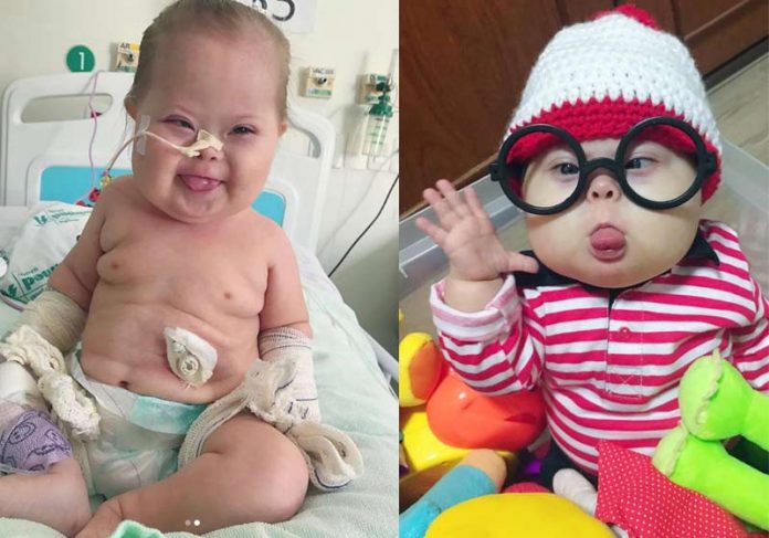 Garoto morou seis meses no hospital e foi submetido a sete cirurgias Morre Super Chico, menino com Down que venceu a Covid duas vezes