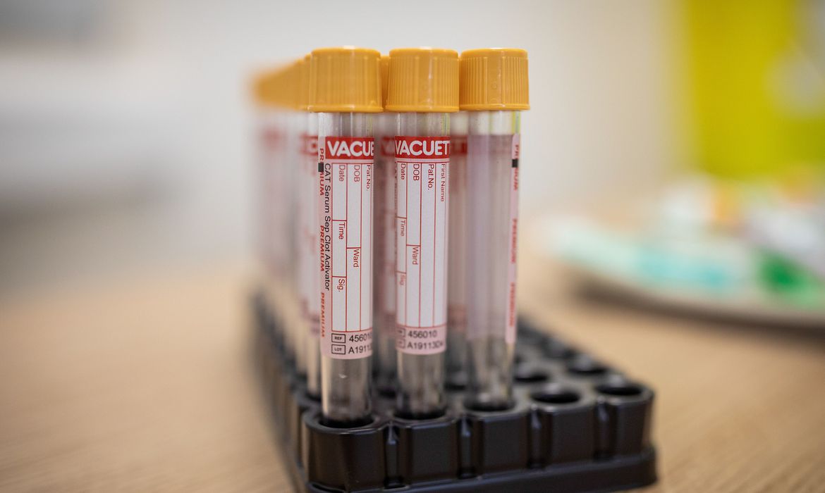 Goiás não registra óbitos por coronavírus pelo segundo dia seguido