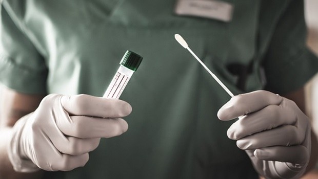 Goiás tem 54 casos da variante Delta e transmissão é comunitária, diz secretário