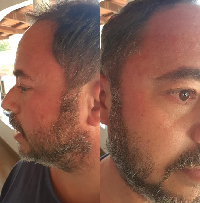 Radialista é agredido por ex-vereador, em Santa Terezinha de Goiás