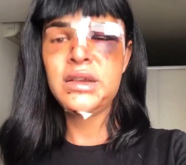 Suspeito de espancar e roubar modelo trans é preso no Rio de Janeiro