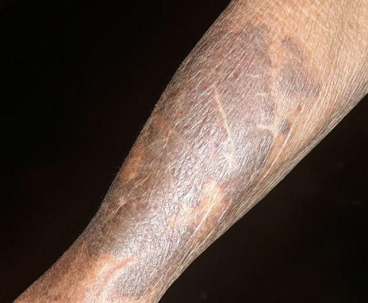 Polícia apreende torturador de idosos na zona rural de Silvânia