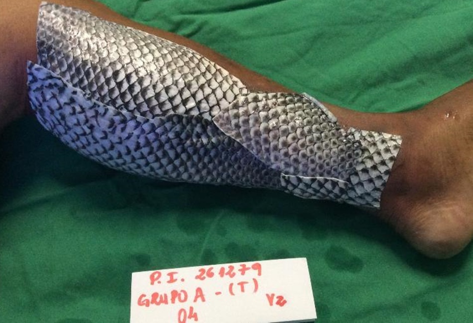 Estudo inédito brasileiro com pele de tilápia pode ajudar vítimas do Líbano