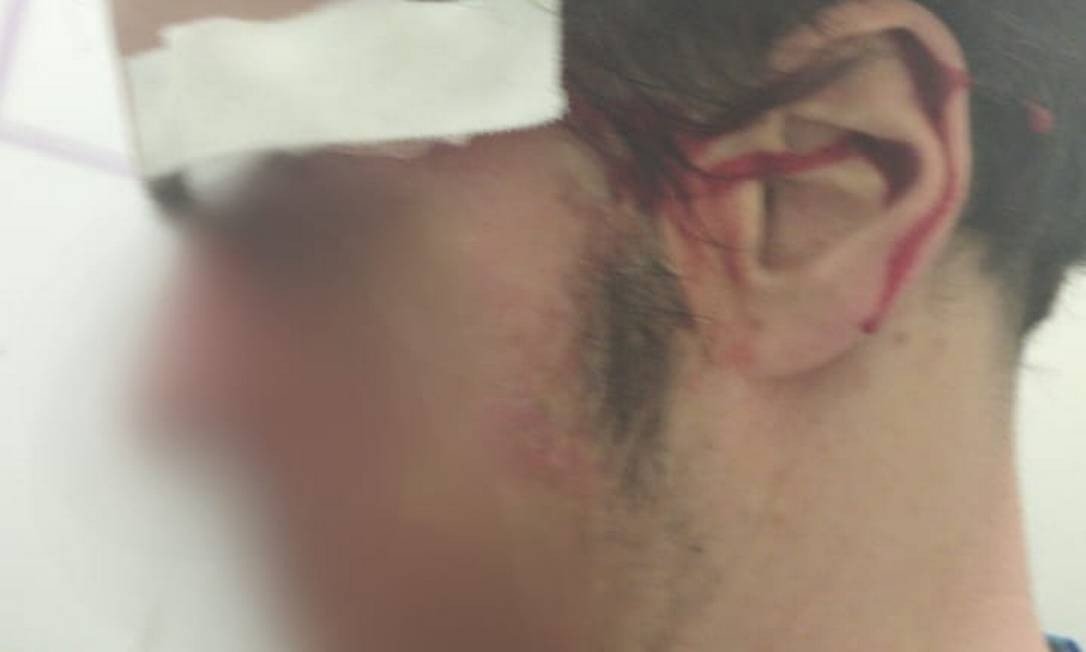 Um médico afirma que foi agredido por um empresário ao tentar acabar com uma festa que ocorria durante a pandemia no Rio de Janeiro. (Foto: reprodução)