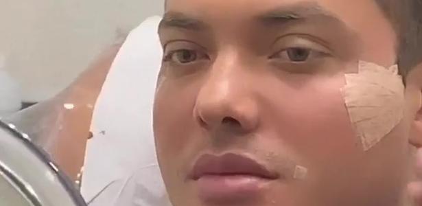 Wesley Safadão faz harmonização facial e internet não perdoa