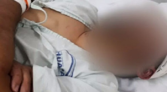 Preso homem suspeito de espancar e jogar farmacêutico em caçamba de lixo