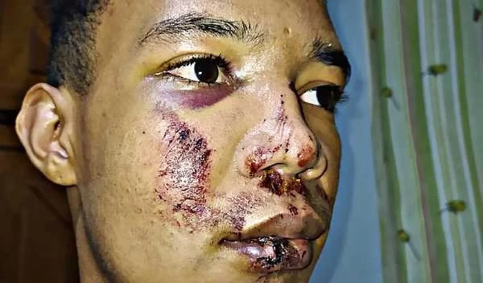 Jovem diz ter sido agredido por racismo e pede ajuda para se recuperar