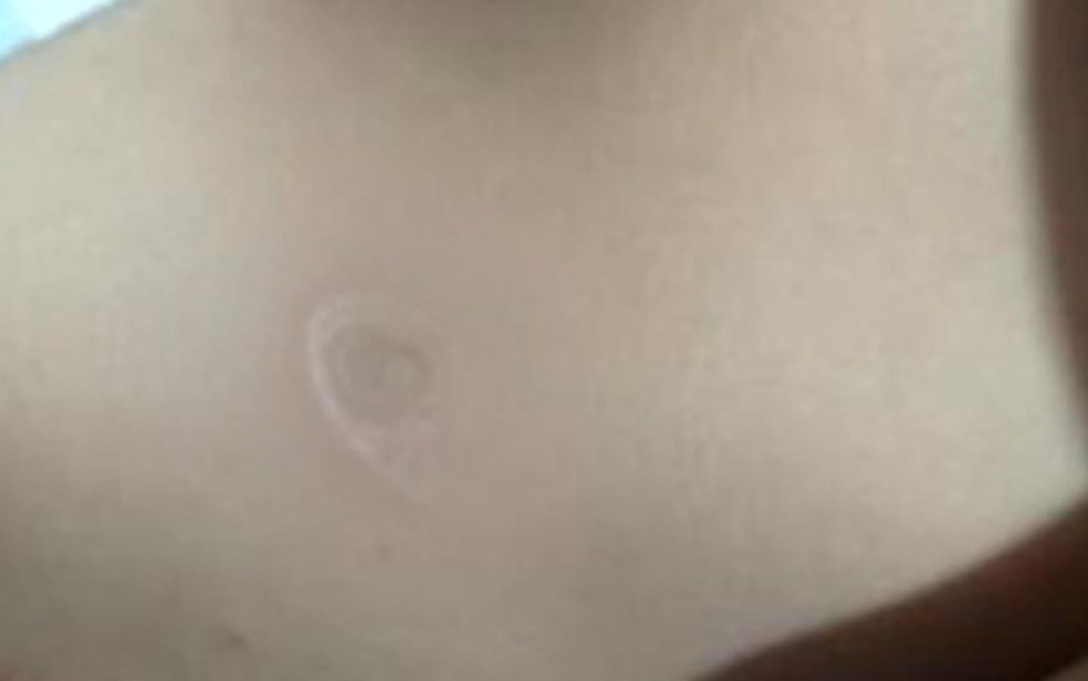 A Polícia Civil (PC) investiga uma mulher suspeita de queimar o filho de 6 meses com cigarro, em Rio Verde. (Foto: divulgação)