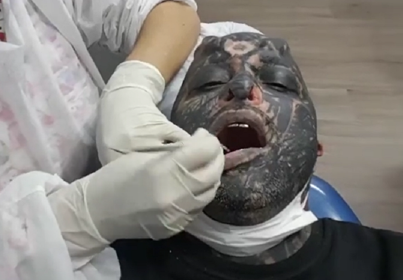 Orc tatuagens piercings Tatuador brasileiro cobre 80% do corpo e coloca presas; confira