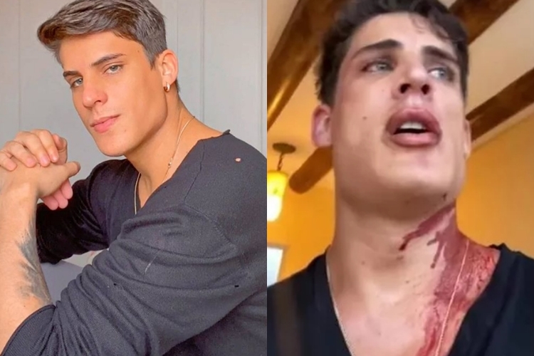 Tiago Ramos, ex de mãe de Neymar, diz ter sido esfaqueado em Cancún (Foto: Reprodução)