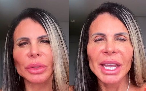 Gretchen mostra harmonização facial e critica 'recalcados'