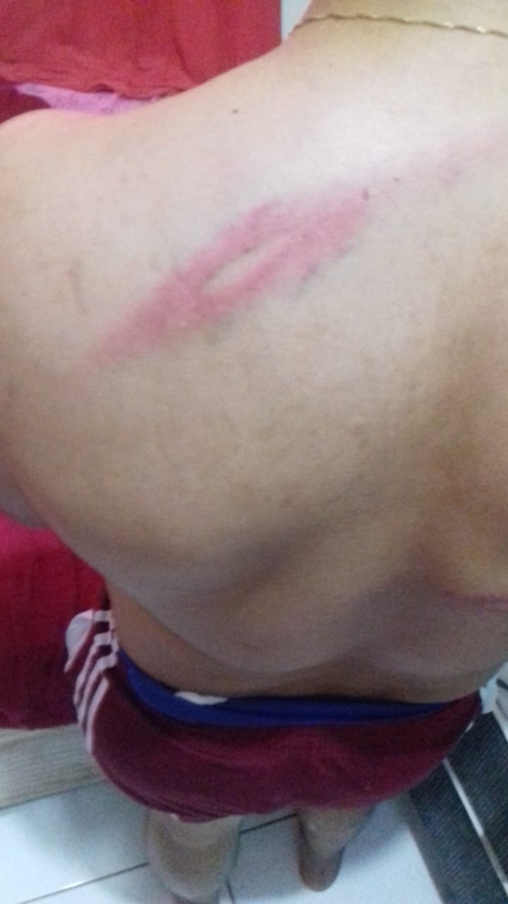 Pai denuncia que filho e enteados foram agredidos por PMs no Réveillon, em Padre Bernardo