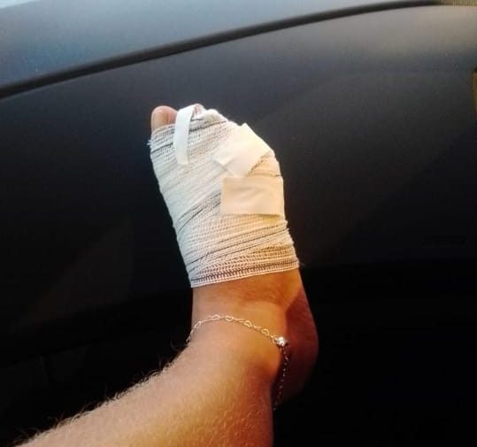 Quatro pessoas são mordidas por piranhas no Lago das Brisas, em Buriti Alegre