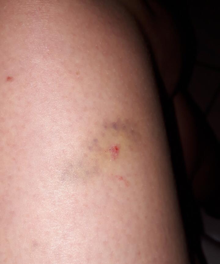 Câmeras mostram agressão de homem a ex-companheira em Morrinhos