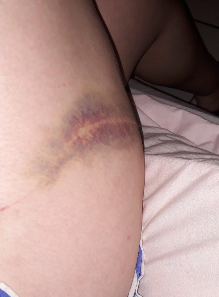 Câmeras mostram agressão de homem a ex-companheira em Morrinhos