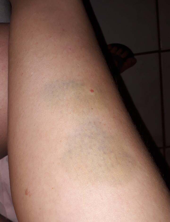 Câmeras mostram agressão de homem a ex-companheira em Morrinhos