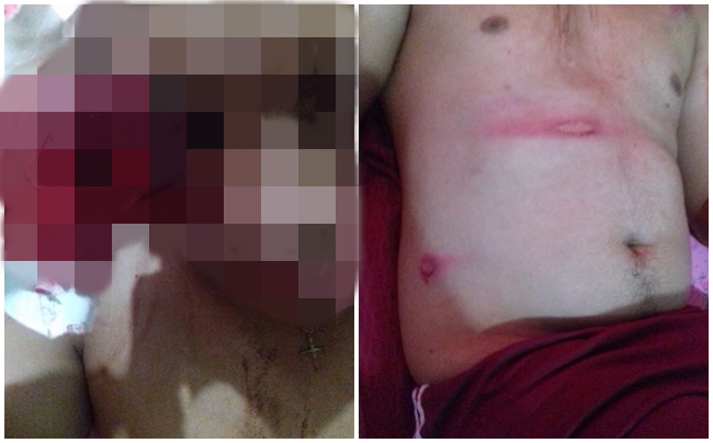 Pai denuncia que filho e enteados foram agredidos por PMs no Réveillon, em Padre Bernardo