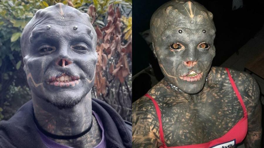 'Homem alienígena' remove parte do lábio superior e quer mais modificações