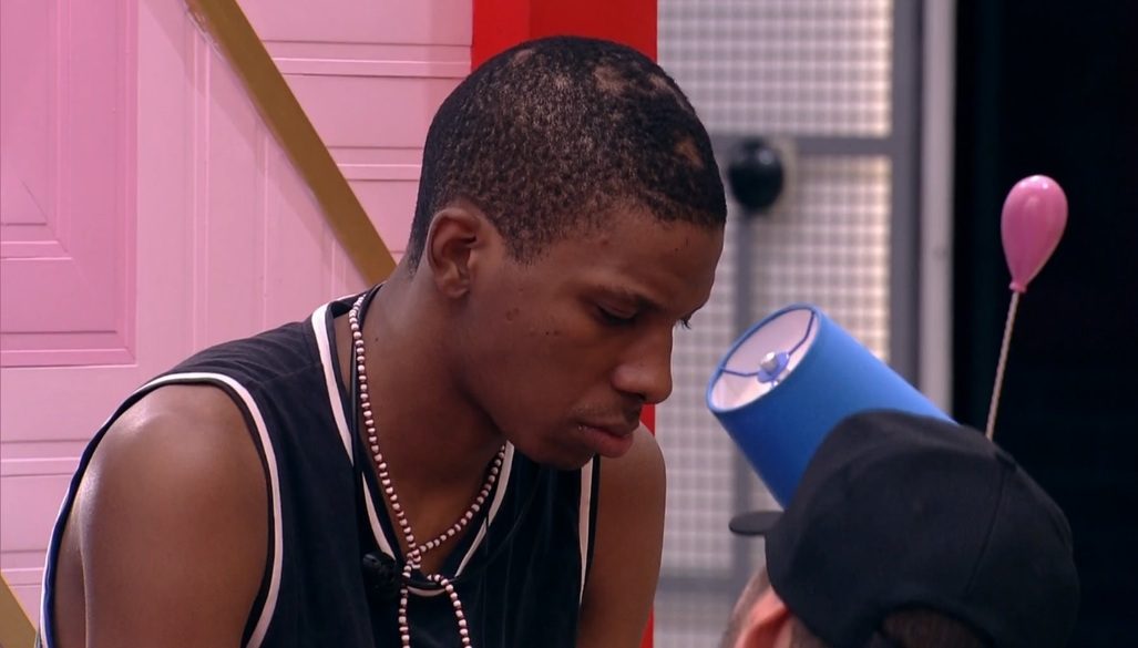 vaquinha lucas BBB 21 gilberto BBB cabelo Alopecia: o que são as falhas que Lucas, do BBB 21, tem na cabeça?