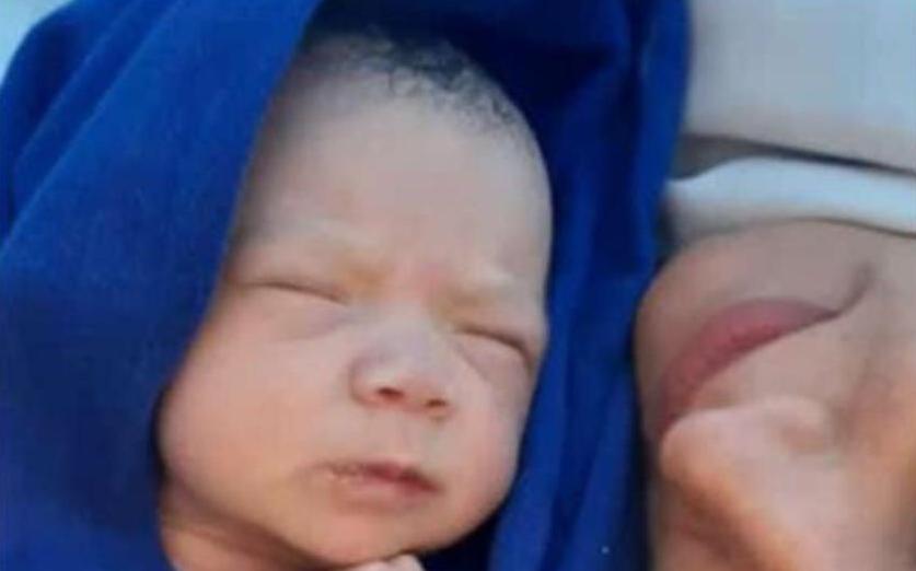 Bebê com 'meio coração' passa pela primeira cirurgia em SP - síndrome -