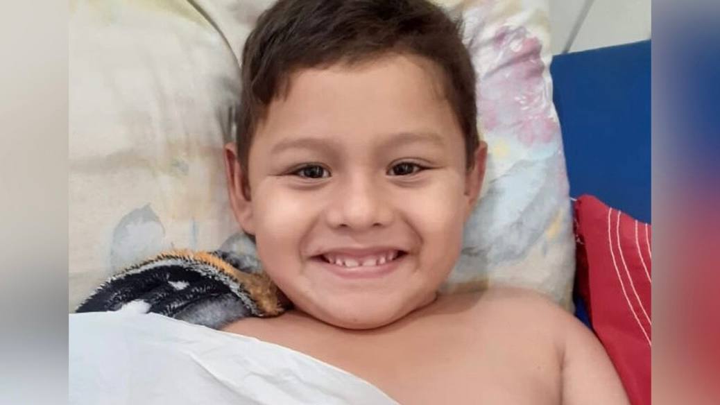 Menino morre após receber quatro anestesias para enfaixar braço quebrado