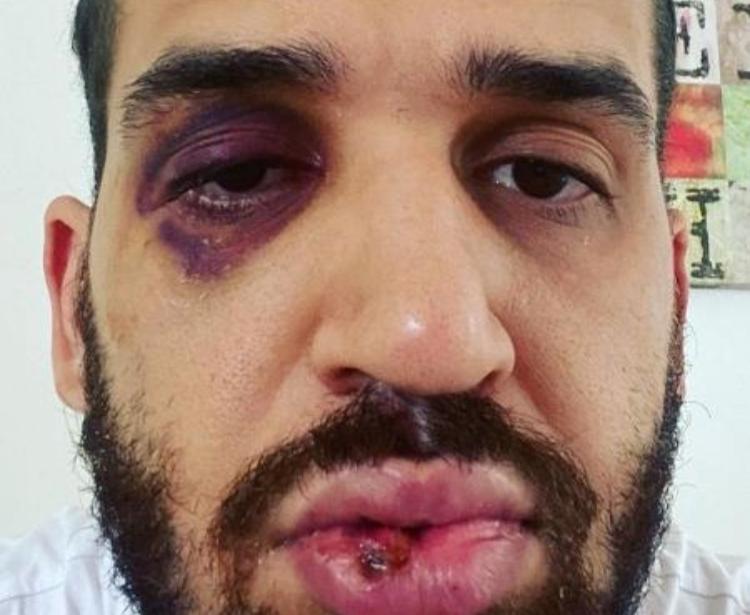 Médico defende lockdown contra parente que iria para balada e é agredido