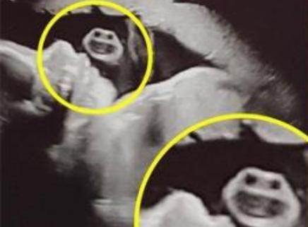 Uma mãe, grávida de sete meses, se assusta ao notar uma criatura bizarra em seu ultrassom no Reino Unido. Hannah Hodgson - Uma mãe, grávida de sete meses, se assusta ao notar uma criatura bizarra em seu ultrassom no Reino Unido - Mãe se assusta ao notar criatura bizarra em ultrassom no Reino Unido